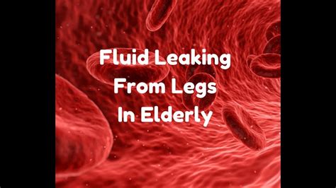 leaking legs in the elderly